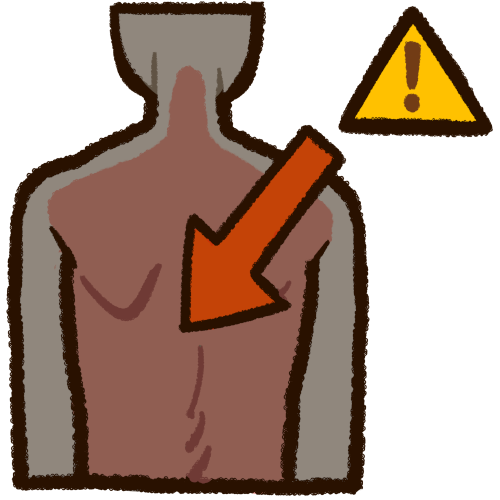 View from behind of a humanoid with grayish skin tone. The spinal area including the neck has been colored red. An overlayed arrow points to the midcenter of the backbone / spinal cord.  Adjacent to the arrow's base is a yellow triangle with an exclamation point inside.